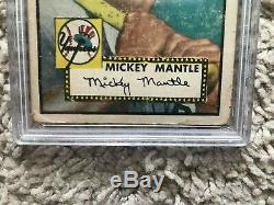 1952 Topps Mickey Mantle #311 Original Vintage PSA 1 (mk)